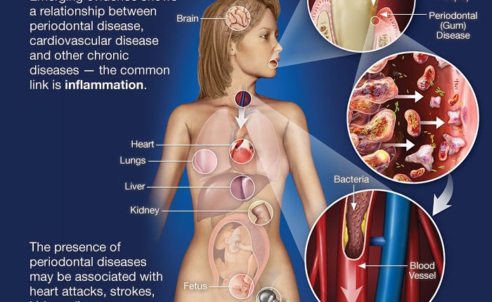 links between your teeth, gums, and Heart.