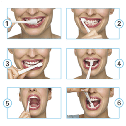 Brushing teeth before or after meal?