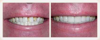 Vistasol Dental