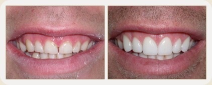 Vistasol Dental