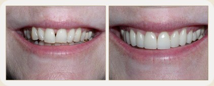Vistasol Dental