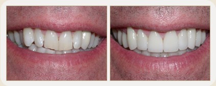 Vistasol Dental