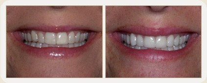 Vistasol Dental