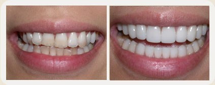 Vistasol Dental