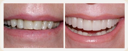 Vistasol Dental