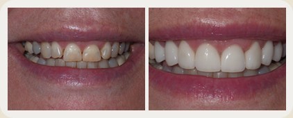 Vistasol Dental