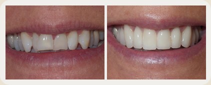 Vistasol Dental