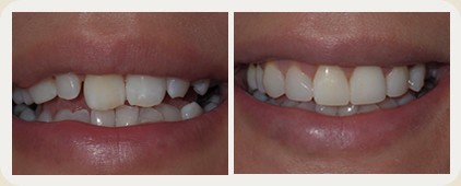 Vistasol Dental