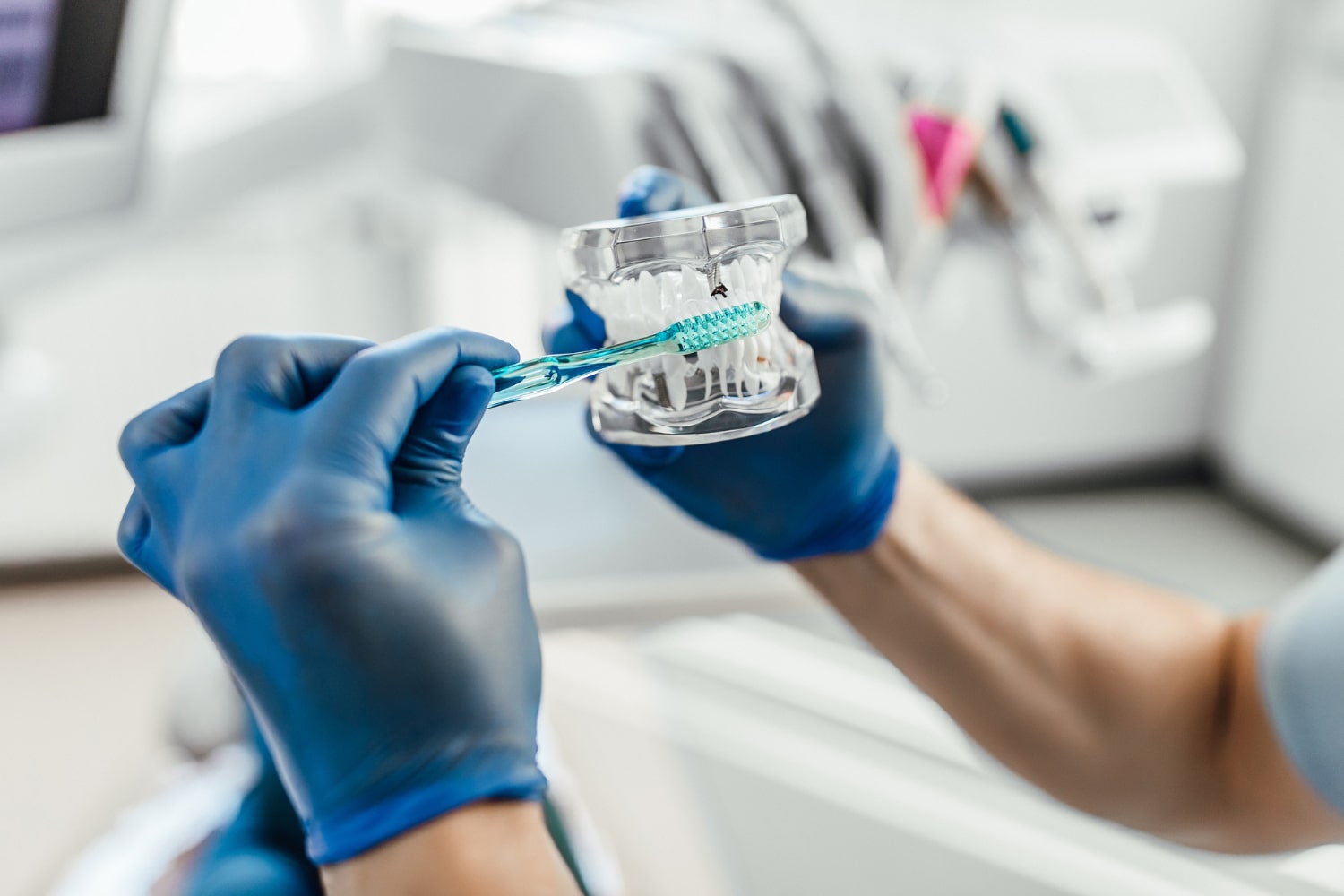 A dental professional demonstrating proper cleaning techniques for a dental implant Montebello model, ensuring excellent oral health and implant care.