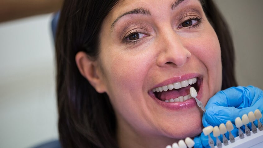 The Ultimate Guide to Dental Implants for Seniors