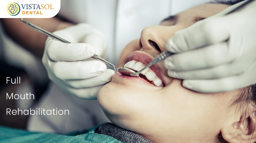 Full Mouth Rehabilitation: Restoring Function and Aesthetics