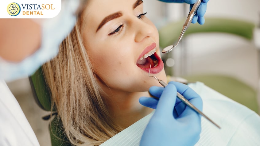The Role of Dental Fillings in Treating Cavities