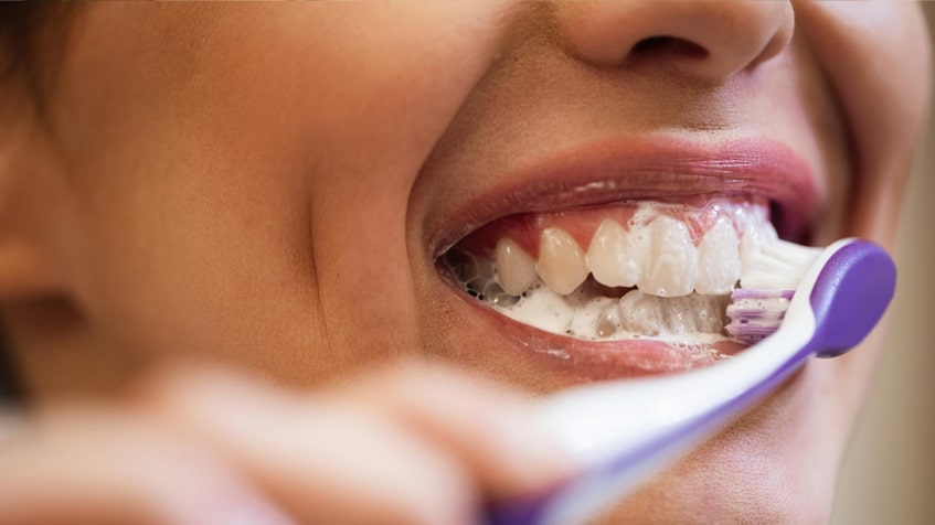 The Role of Fluoride in Preventing Tooth Decay